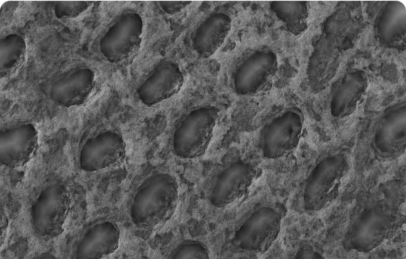 2. After 4 Weeks of Using NanoGum